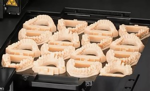 Сфера применения сканирования и печати 3D в стоматологии