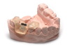 Фотополимер HARZ LABS Dental Pink для 3D принтеров LCD/DLP 1 л